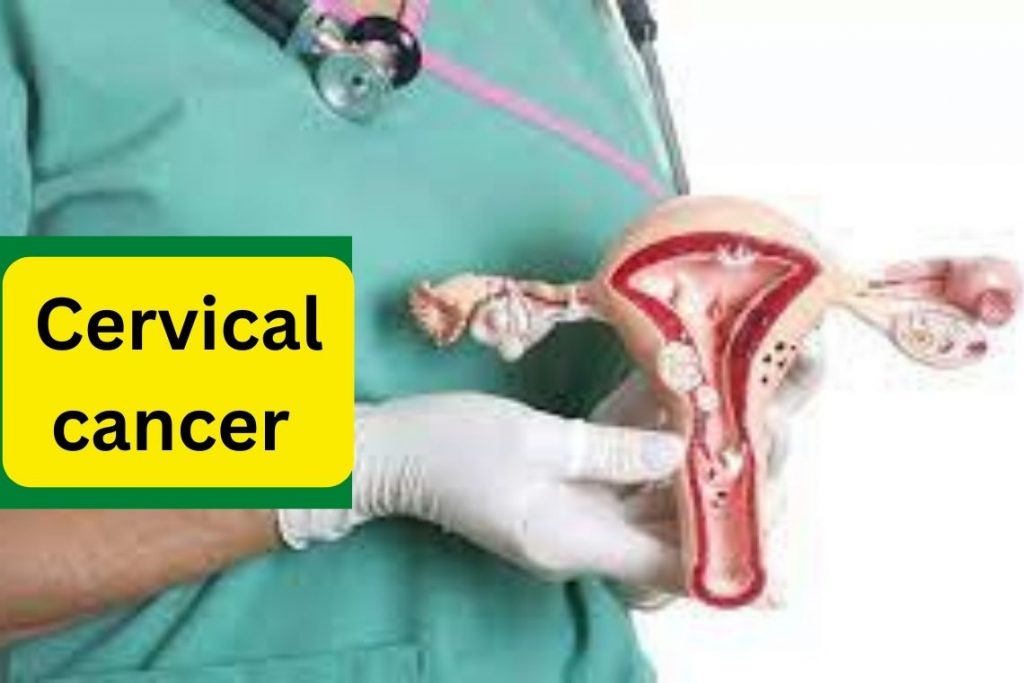 
Cervical cancer awareness